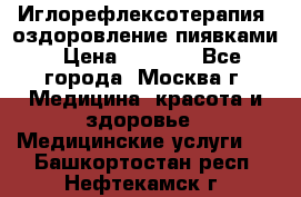 Иглорефлексотерапия, оздоровление пиявками › Цена ­ 3 000 - Все города, Москва г. Медицина, красота и здоровье » Медицинские услуги   . Башкортостан респ.,Нефтекамск г.